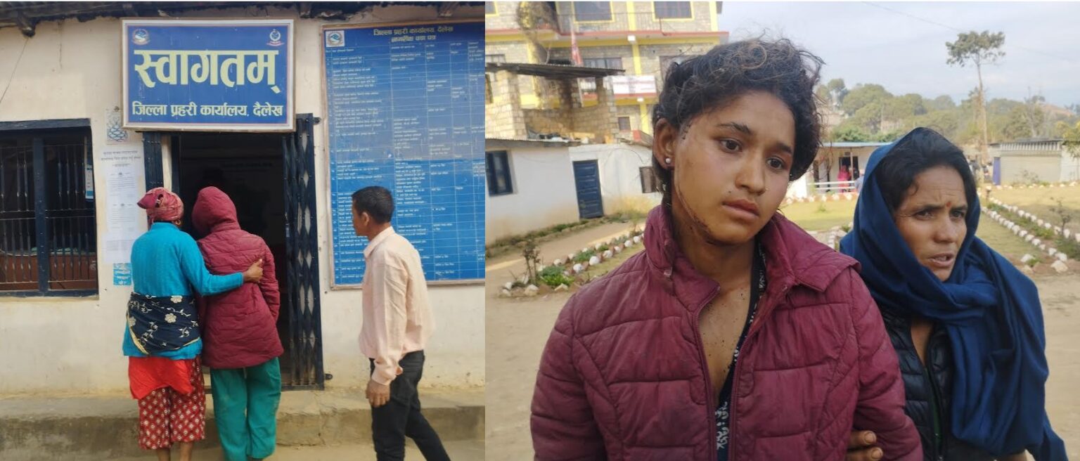 अन्तर्राष्ट्रिय महिला दिवसको दिनमै पत्निमाथी चक्कू प्रहार